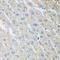 Mixed lineage kinase domain-like protein antibody, LS-C334151, Lifespan Biosciences, Immunohistochemistry paraffin image 