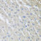 Mixed Lineage Kinase Domain Like Pseudokinase antibody, LS-C334151, Lifespan Biosciences, Immunohistochemistry paraffin image 