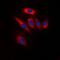 Phosphatase And Tensin Homolog antibody, orb318864, Biorbyt, Immunofluorescence image 