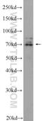 Scm Polycomb Group Protein Like 2 antibody, 25544-1-AP, Proteintech Group, Western Blot image 