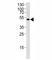 Suppressor Of Cytokine Signaling 4 antibody, F41736-0.4ML, NSJ Bioreagents, Immunohistochemistry paraffin image 