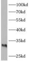 A-Raf Proto-Oncogene, Serine/Threonine Kinase antibody, FNab00522, FineTest, Western Blot image 