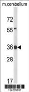 Claudin Domain Containing 1 antibody, 64-083, ProSci, Western Blot image 