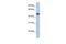 Adipocyte Plasma Membrane Associated Protein antibody, GTX46052, GeneTex, Western Blot image 