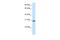 Potassium Channel Tetramerization Domain Containing 6 antibody, A13579, Boster Biological Technology, Western Blot image 