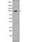 Forkhead Box O3 antibody, PA5-64678, Invitrogen Antibodies, Western Blot image 