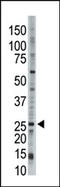 Ubiquitin Conjugating Enzyme E2 E3 antibody, AP12082PU-N, Origene, Western Blot image 