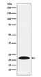 Proteasome Subunit Beta 9 antibody, M02867, Boster Biological Technology, Western Blot image 