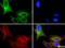 Transient Receptor Potential Cation Channel Subfamily M Member 8 antibody, NBP1-97311, Novus Biologicals, Immunofluorescence image 