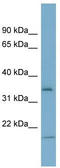 Insulin Like Growth Factor Binding Protein 2 antibody, TA336227, Origene, Western Blot image 