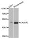 Calcitonin Receptor Like Receptor antibody, PA5-76414, Invitrogen Antibodies, Western Blot image 