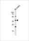 Actin Like 6A antibody, LS-C344638, Lifespan Biosciences, Western Blot image 