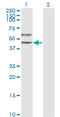 Serpin Family A Member 3 antibody, LS-B5371, Lifespan Biosciences, Western Blot image 