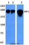 Zinc Finger E-Box Binding Homeobox 2 antibody, A01169-1, Boster Biological Technology, Western Blot image 