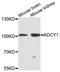 Adenylate Cyclase 1 antibody, STJ111819, St John