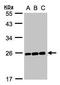 HsMAD2 antibody, TA308923, Origene, Western Blot image 