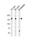 Fibrinogen Alpha Chain antibody, LS-C159645, Lifespan Biosciences, Western Blot image 