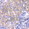 Ribosomal Protein S6 Kinase B1 antibody, A2190, ABclonal Technology, Immunohistochemistry paraffin image 