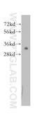 RAD1 Checkpoint DNA Exonuclease antibody, 11726-2-AP, Proteintech Group, Western Blot image 