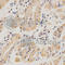 Serpin Family F Member 1 antibody, A1673, ABclonal Technology, Immunohistochemistry paraffin image 