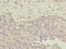 Centrosomal Protein 72 antibody, LS-C675509, Lifespan Biosciences, Immunohistochemistry paraffin image 