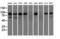 Transforming Acidic Coiled-Coil Containing Protein 3 antibody, M02876-2, Boster Biological Technology, Western Blot image 