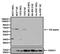 Estrogen Receptor 2 antibody, MA5-14104, Invitrogen Antibodies, Western Blot image 