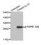 Heat Shock Protein Family B (Small) Member 1 antibody, STJ22182, St John