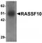 Ras association domain-containing protein 10 antibody, TA320197, Origene, Western Blot image 