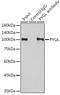 Glycogen Phosphorylase L antibody, GTX33448, GeneTex, Immunoprecipitation image 