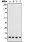 Transforming Growth Factor Alpha antibody, orb214660, Biorbyt, Western Blot image 