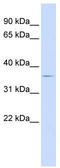 Tribbles Pseudokinase 2 antibody, TA333723, Origene, Western Blot image 