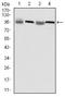 Eukaryotic Translation Elongation Factor 2 antibody, LS-C171578, Lifespan Biosciences, Western Blot image 