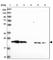 ATP Synthase Peripheral Stalk Subunit OSCP antibody, HPA041394, Atlas Antibodies, Western Blot image 
