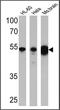 DNA Methyltransferase 1 Associated Protein 1 antibody, PA1-886, Invitrogen Antibodies, Western Blot image 