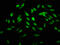 Homeobox B4 antibody, LS-C673290, Lifespan Biosciences, Immunofluorescence image 