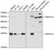 TNF Superfamily Member 12 antibody, GTX16436, GeneTex, Western Blot image 