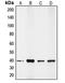 Caudal Type Homeobox 2 antibody, LS-C351986, Lifespan Biosciences, Western Blot image 