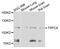 Transient Receptor Potential Cation Channel Subfamily C Member 6 antibody, STJ110454, St John