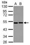 Eukaryotic Translation Initiation Factor 2 Subunit Beta antibody, LS-C155267, Lifespan Biosciences, Western Blot image 