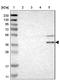 Wnt Family Member 7A antibody, NBP1-86071, Novus Biologicals, Western Blot image 