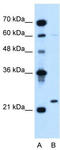 Immunoglobulin Lambda Like Polypeptide 1 antibody, TA344164, Origene, Western Blot image 