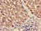 Pancreatic Lipase Related Protein 3 antibody, CSB-PA018265LA01HU, Cusabio, Immunohistochemistry paraffin image 