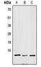 Small Nuclear Ribonucleoprotein D3 Polypeptide antibody, LS-C353778, Lifespan Biosciences, Western Blot image 