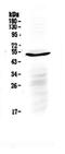 Interleukin 6 Receptor antibody, PA5-79506, Invitrogen Antibodies, Western Blot image 