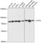Leucine Zipper Tumor Suppressor 2 antibody, GTX66271, GeneTex, Western Blot image 