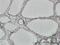 Heterogeneous Nuclear Ribonucleoprotein M antibody, H00004670-M03, Novus Biologicals, Immunohistochemistry paraffin image 