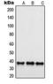 SUMO1 Activating Enzyme Subunit 1 antibody, orb214956, Biorbyt, Western Blot image 