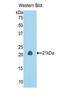 Involucrin antibody, LS-C294948, Lifespan Biosciences, Western Blot image 