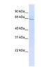 Glucagon Like Peptide 2 Receptor antibody, NBP1-59029, Novus Biologicals, Western Blot image 